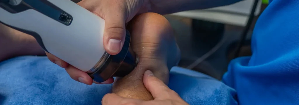 Shockwave klachten achillespees header